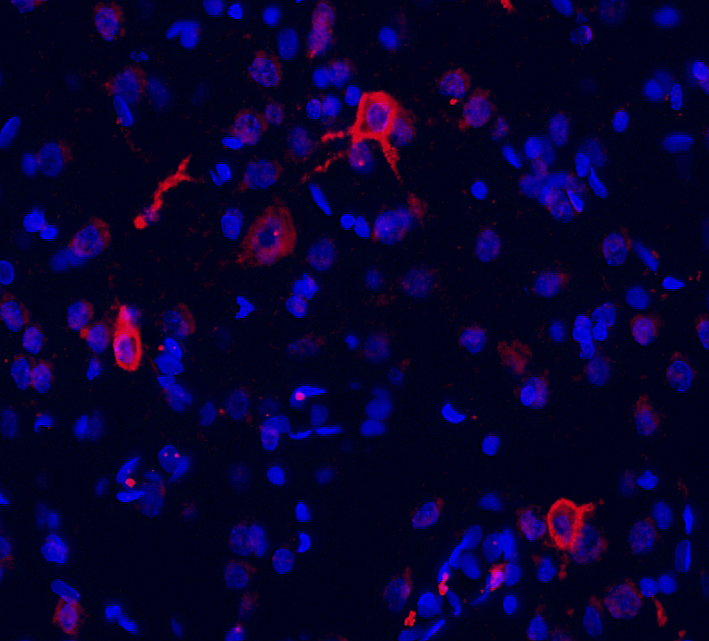 Glutamate Receptor 1 (P19) Rabbit mAb main image 0